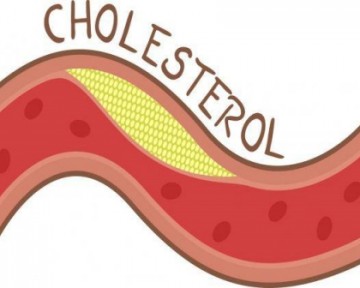 Cholesterol là gì ? Những điều cần biết để có sức khỏe tốt